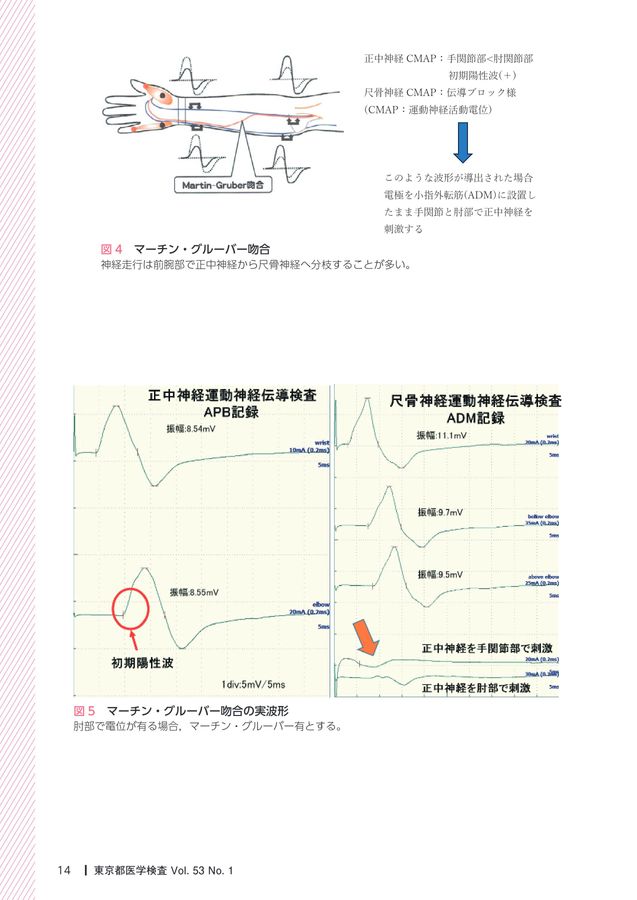 関節の痛み J.McMメンネル著 EMS Pocket Heat Neck Ⅱ – 株式会社ルネサンス 公式オンライン