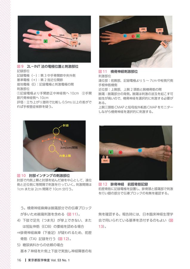 手足の骨膜反射療法 手穴点圧の秘訣 手足の骨膜反射療法 手穴点圧の秘訣