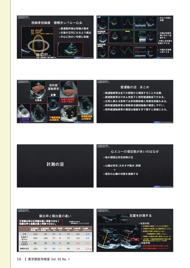 本当のPMTC : その意味と価値 : 臨床研究30年のエビデンスに基づいたプ… 海外第Ⅲ相比較試験 有効性｜ベバシズマブ